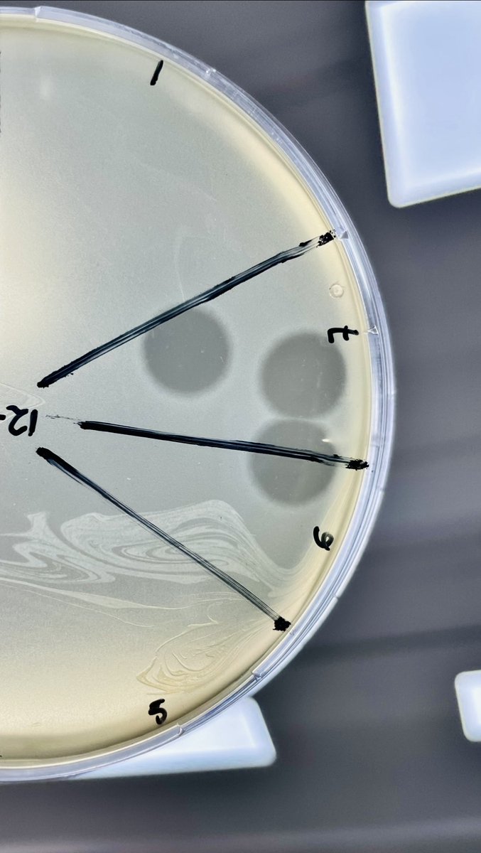 gabrielpaba's tweet photo. Beautiful and clear phage plaques 🧫 https://t.co/9mWpyOjRnL