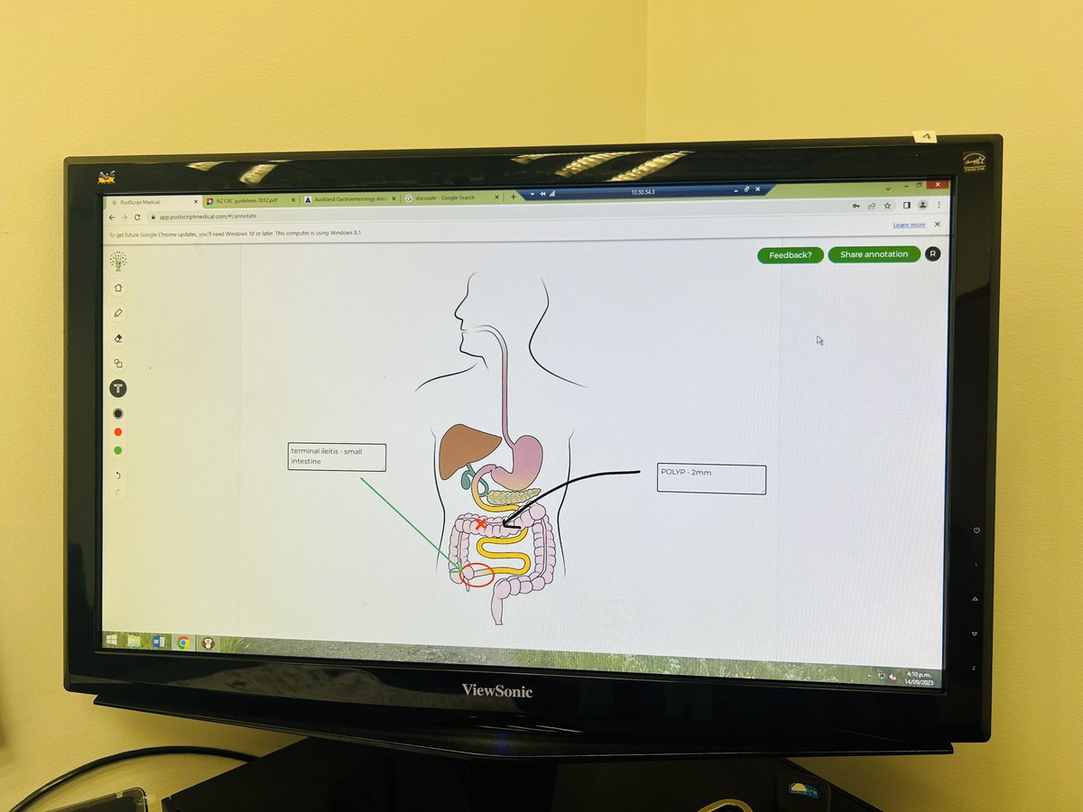 Positive feedback ++ from a patient in clinic today. Visual learner and an art teacher 😊