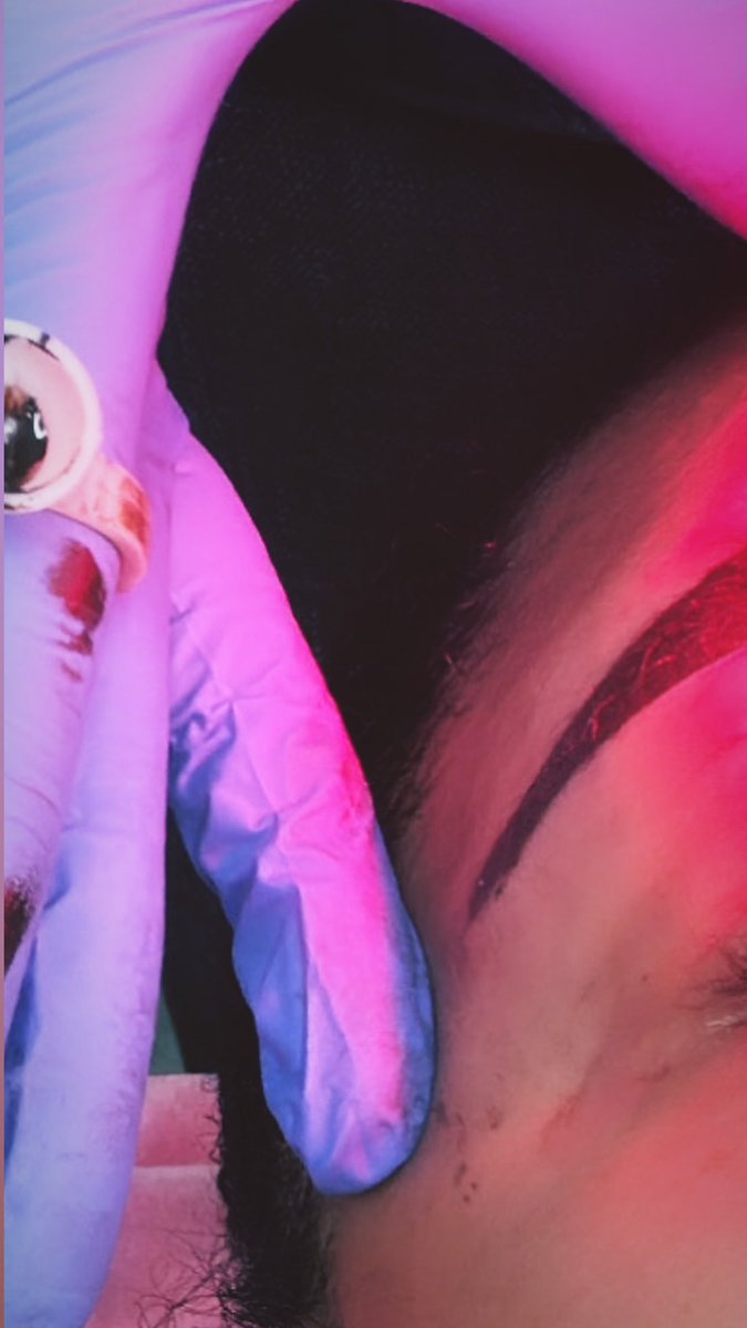 rachelsdiaryy's tweet image. #nanoblading