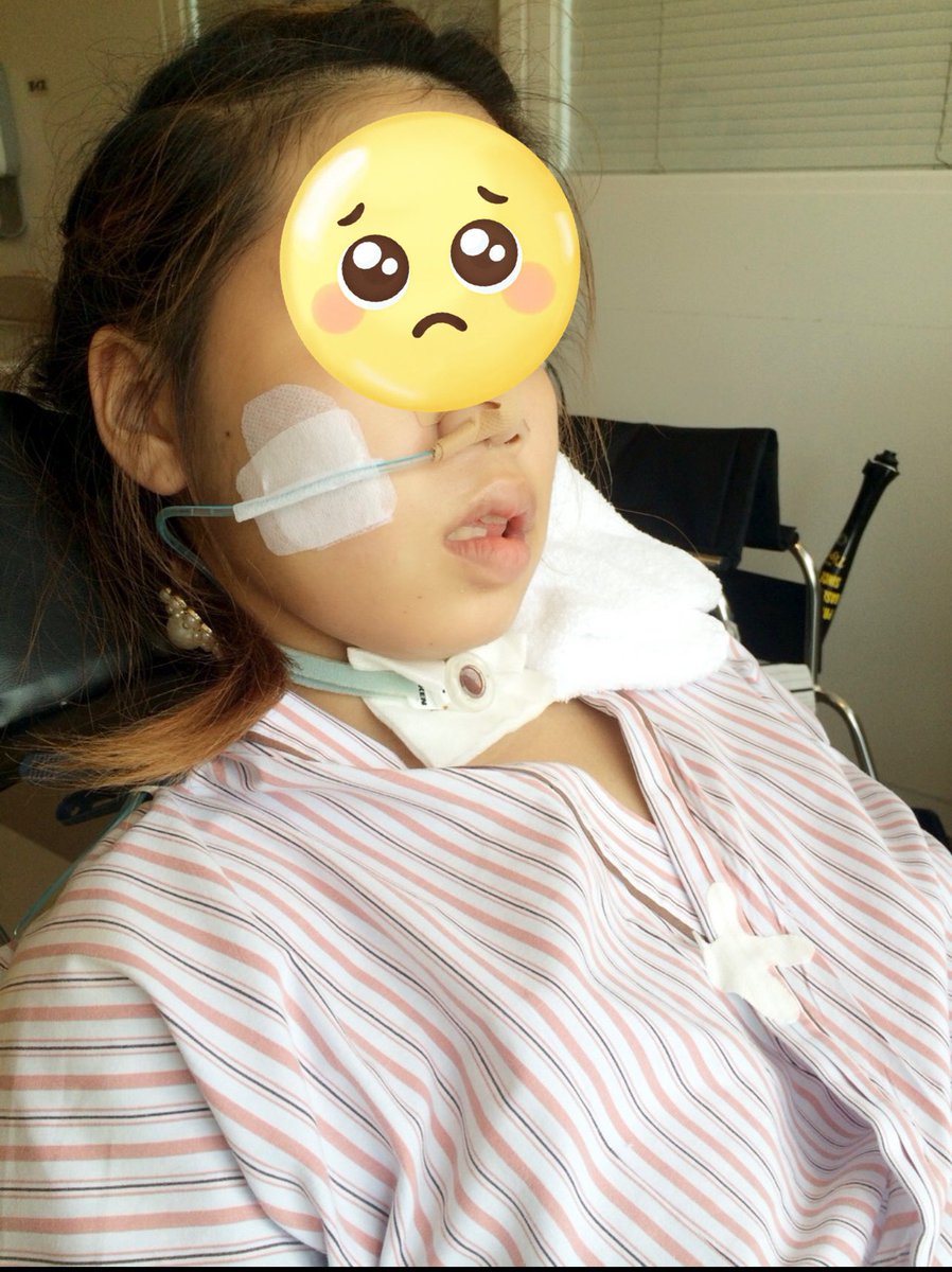 SOUA0714's tweet photo. 過去の写真見ててこんな時もあったなーって！
意識ない時にも看護婦さんが綺麗に髪の毛してくれてた。
意識戻っても気管切開の管喋れない！手の硬直 首もすわらない支えあり！鼻の栄養の後は胃瘻！唯一自発呼吸はしてくれてた！
3ヶ月意識不明で今ロボハル挑戦中︎👍🏻 ̖́-よく頑張ってくれたって思う！ https://t.co/gfVSO319q1