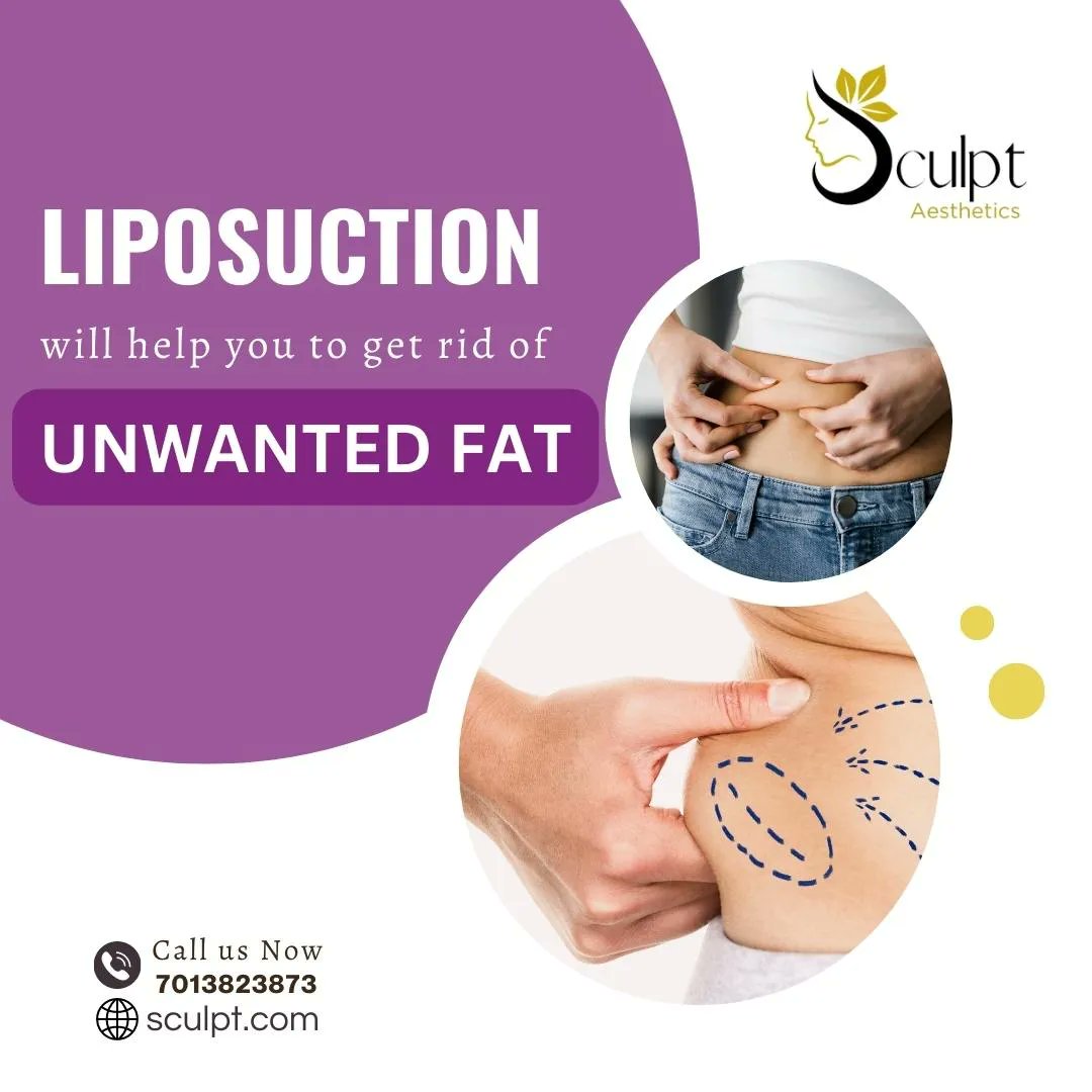 'Reshaping my world, starting with my curves. 💃💉 #LipoTransformation' 
#SelfLove
#SurgicalEnhancement
#SculptedLook
#AestheticGoals
#LipoRecovery 
call/whatsapp:7013823873