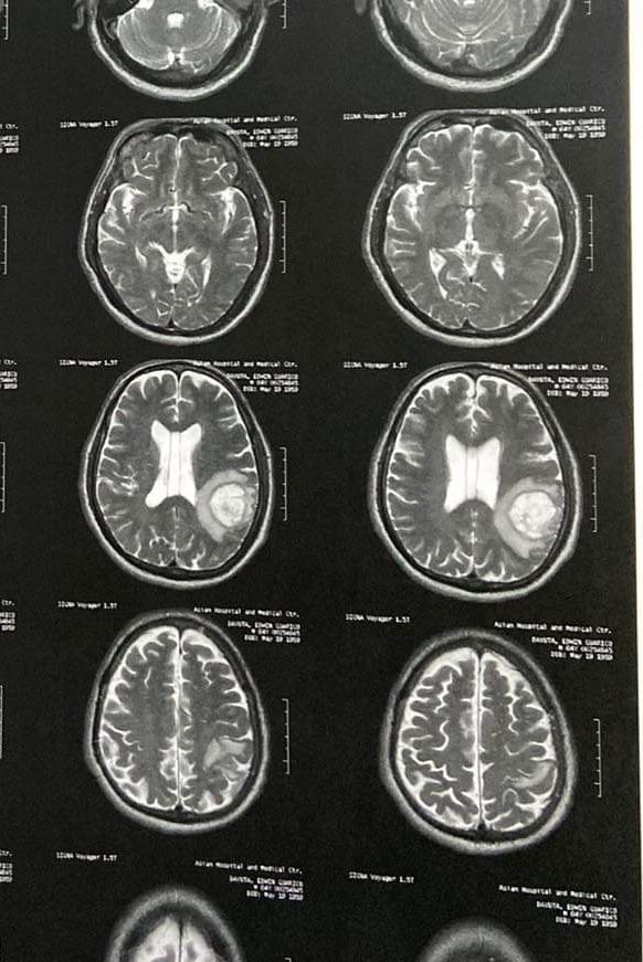 jonnahdayuta's tweet photo. This growth happened in the span of approximately six weeks. He needs this surgery ASAP.

Please, if you can help, please consider helping my dad. Thank you. 🩵

https://t.co/d1Im5uRdu1 https://t.co/xrEiIAyZOG
