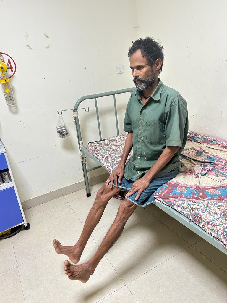 ##Patient of traumatic Spine compression where lumbar spine successfully operated by HOD orthopedic in MKCG MCH,berhampur 
Patient is now able to walk and fine .<a href="/MoSarkar5T/">MoSarkar 5T</a> <a href="/Ganjam_Admin/">Collector & District Magistrate, Ganjam</a> <a href="/nhmodisha/">NHM Odisha</a> <a href="/HFWOdisha/">H & FW Dept Odisha</a> <a href="/CMO_Odisha/">CMO Odisha</a>