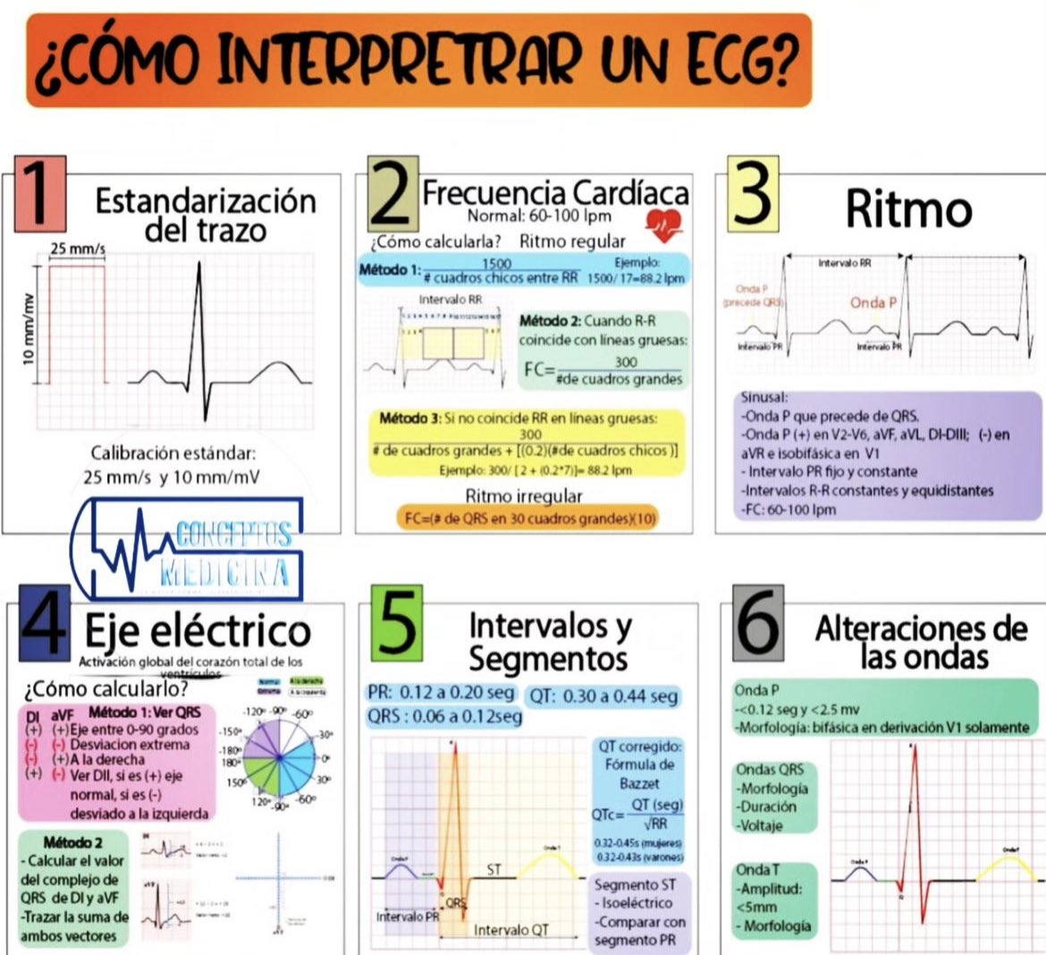 farmacotips's tweet photo. Cómo interpretar un EKG: https://t.co/NrAFWUWK5N