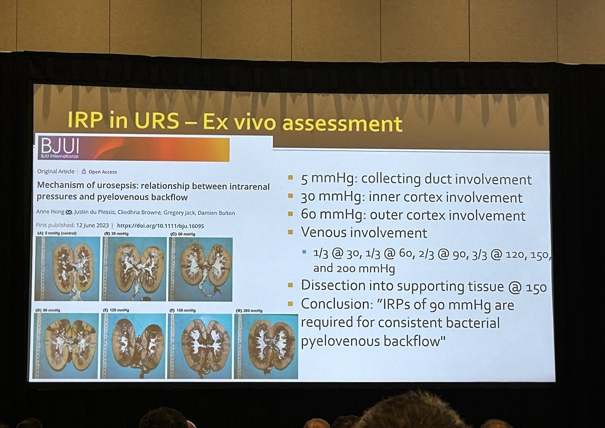 Very interesting data on intrarenal pressure during ureteroscopy presented by Dr. Robert Marcovich! #FUS2023
