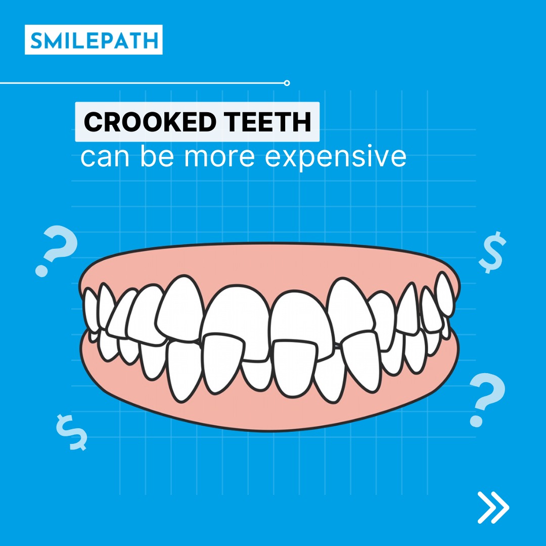SmilePathAus's tweet image. Start your Smile Journey today before it's too late.
Visit the link bit.ly/3XpEi9K and get your smile journey started!
.
.
.
#Smilepath #comfert #dentaltreatment #dental #smile #straightteeth #brightsmile #invisiblealigner #teethstraightening #gumproblems #expensive