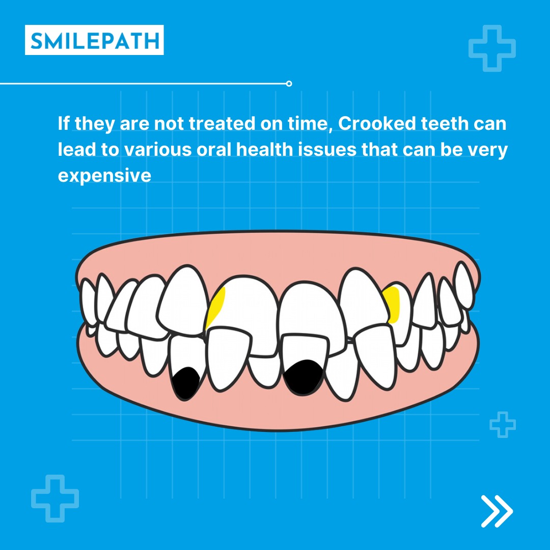 SmilePathAus's tweet image. Start your Smile Journey today before it's too late.
Visit the link bit.ly/3XpEi9K and get your smile journey started!
.
.
.
#Smilepath #comfert #dentaltreatment #dental #smile #straightteeth #brightsmile #invisiblealigner #teethstraightening #gumproblems #expensive