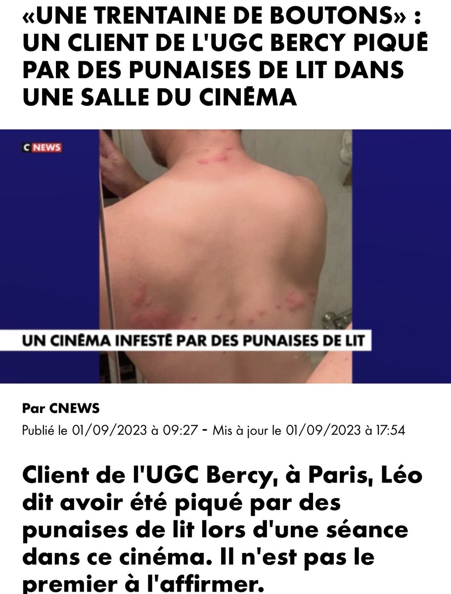 Nawal_'s tweet photo. Merci à Léo pour son témoignage, piqué par des punaises de lit au cinéma UGC Bercy. (Mêmes piqûres de punaises, sur mon dos, mon coude, moins à la nuque).
Lui c’était le 16 août salle 24 siège K10, (moi le 17 août salle 17 siège I08).  #Cinema #Bercy #UGC 
https://t.co/t7HV9XZjY5 https://t.co/noSEfaFKZU
