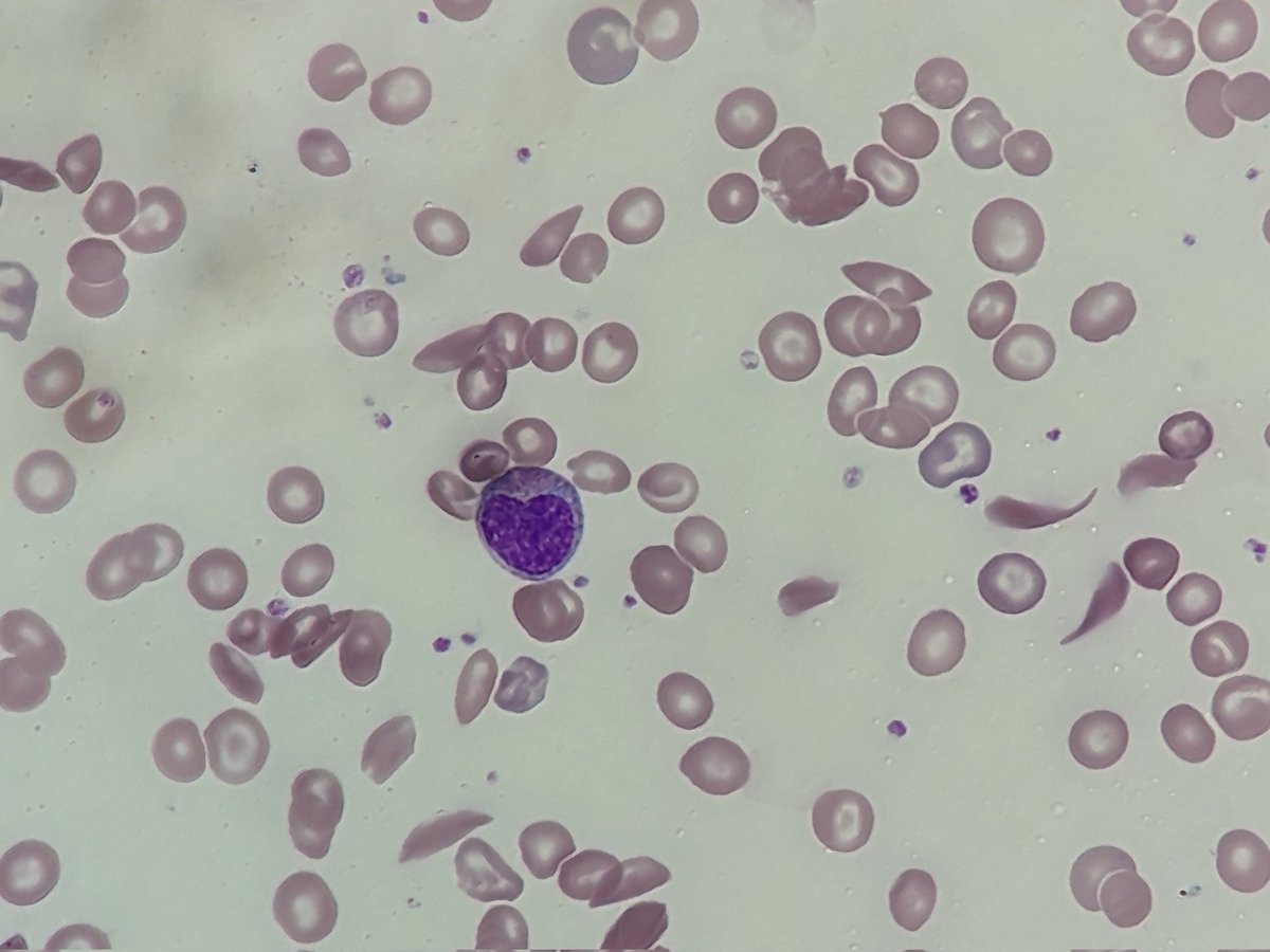 BloodScientist's tweet photo. Sharing some ❤️ on sickle cell awareness month. 🩸 https://t.co/cOQ1Jv8jAZ