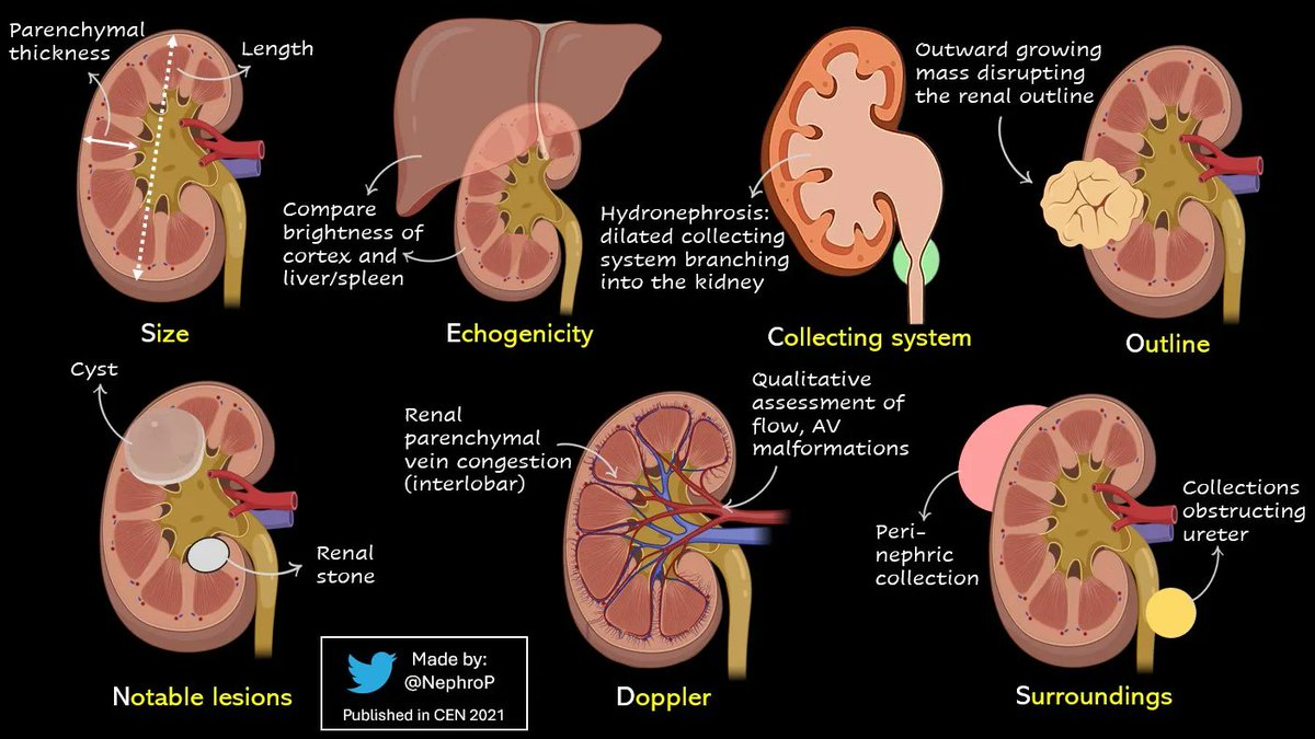 NephroP's tweet photo. Lesson #2 of the day. 
Remember the SECONDS checklist for systematic interpretation of kidney #POCUS 

#MedEd #FOAMed #FOAMcc 
🔗 https://t.co/AUbMdxbjNC https://t.co/v40RTv5gJi