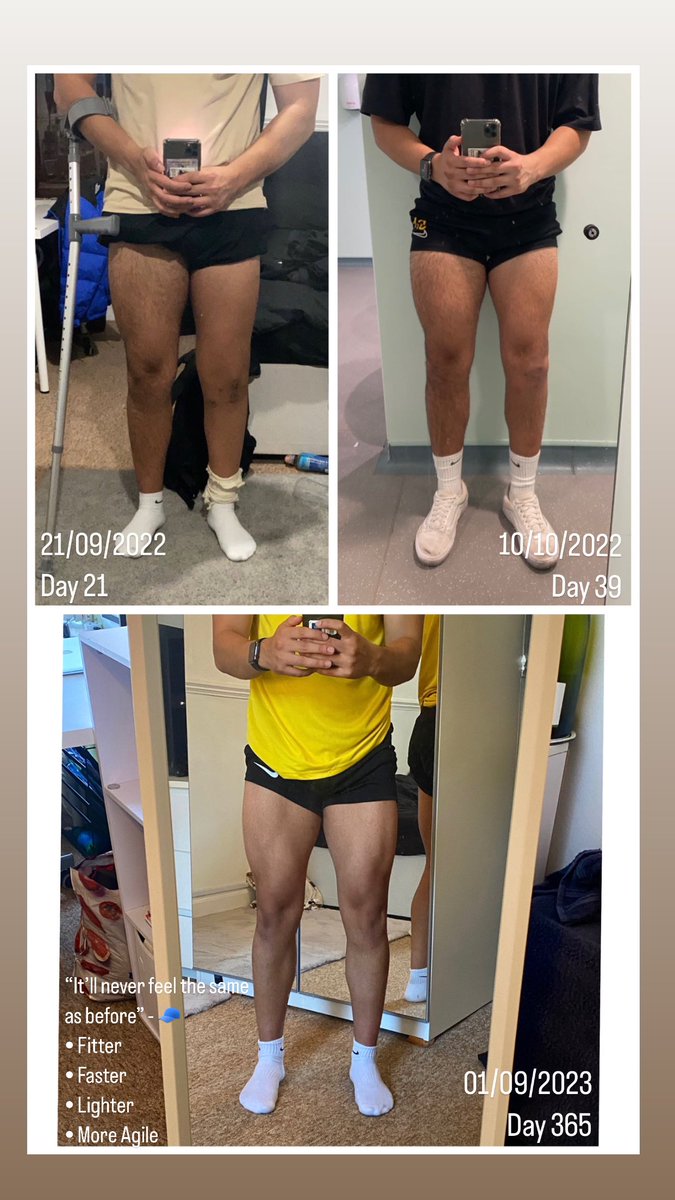Yesterday marked a special milestone - 1 Year Post OP🙏

I am so grateful for the treatment I received to allow me to return to full football by <a href="/mackayclinic1/">Prof Gordon Mackay</a> 

Never ever let anyone tell you that a knee injury will finish you. It’s definitely a setback, but nothing more…