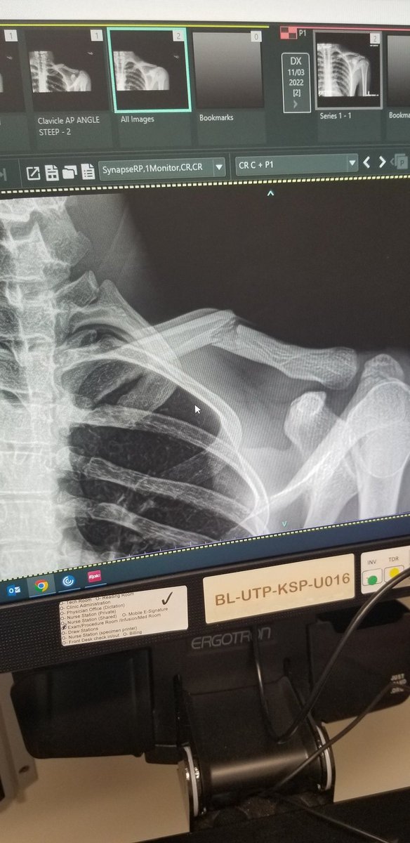 Just like that my football career is over. Having surgery on Wednesday.