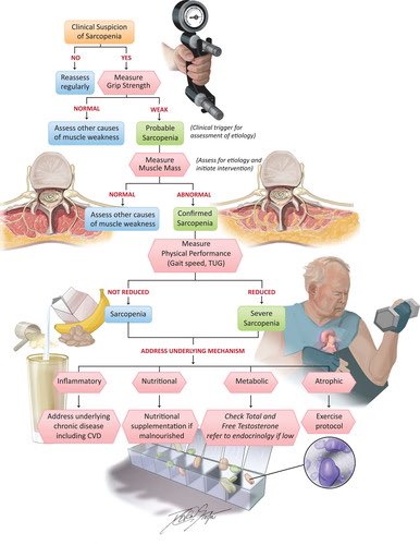Screening/diagnostic approach for sarcopenia &amp; potential interventions:

>inflammatory 👉🏾address underlying chronic condition/s
>nutritional 👉🏾consider supplements
>metabolic 👉🏾check testosterone
>atrophic 👉🏾exercise protocol

#sarcopenia #ageing #muscle

ahajournals.org/doi/10.1161/CI…