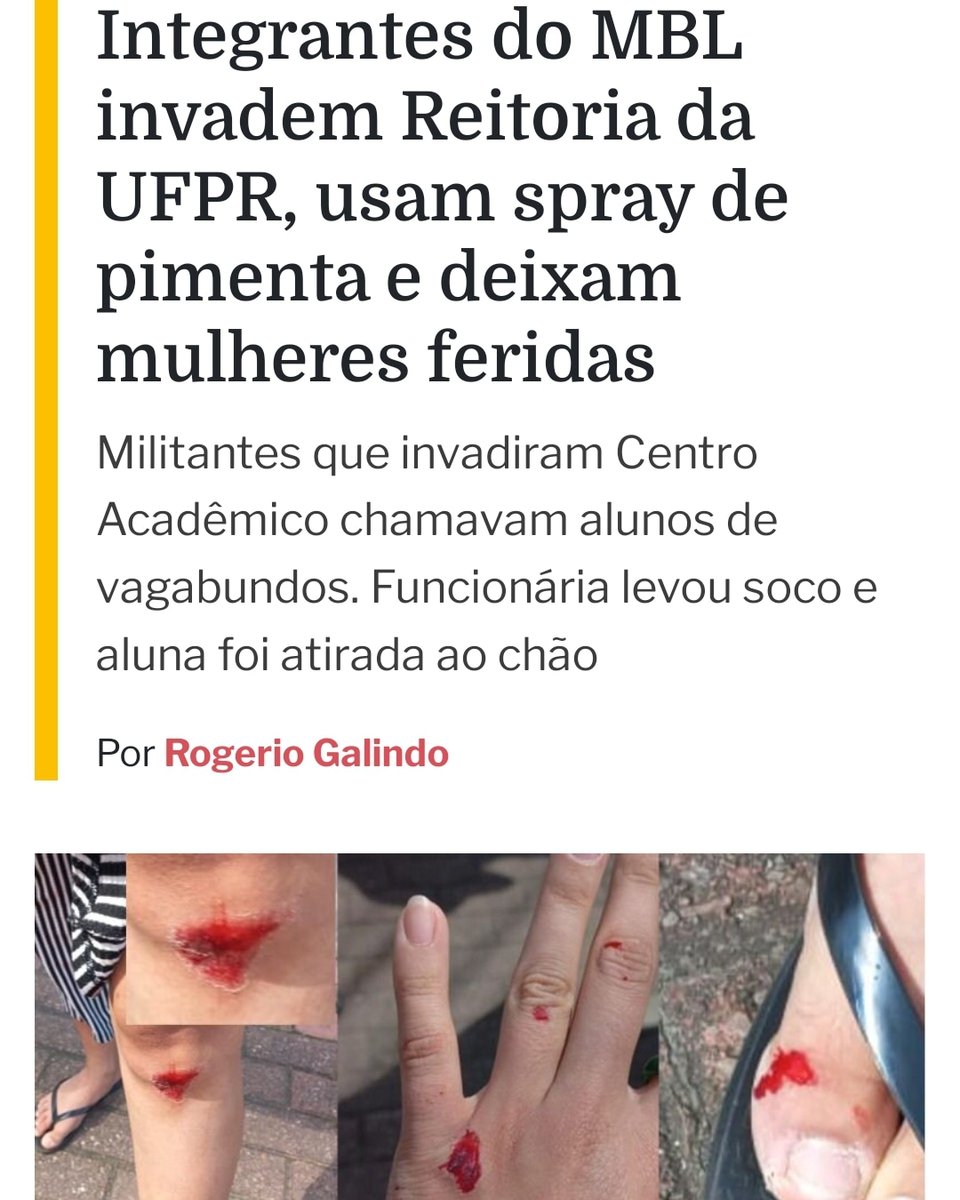 cwbresiste's tweet photo. 🚨 ABSURDO! 🚨 https://t.co/vcyg1TwOvR