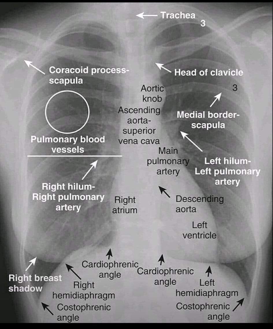 Chest anatomy

#chest #chestercountypa #chestday #chestfeeding #chestercounty #chesterfieldva  #anatomyandphysiology #anatomyart #anatomy #anatomystudy #anatoly #anatomydrawing #anatomyadventures #anatomyclass #chestanatomy #HeartHealth