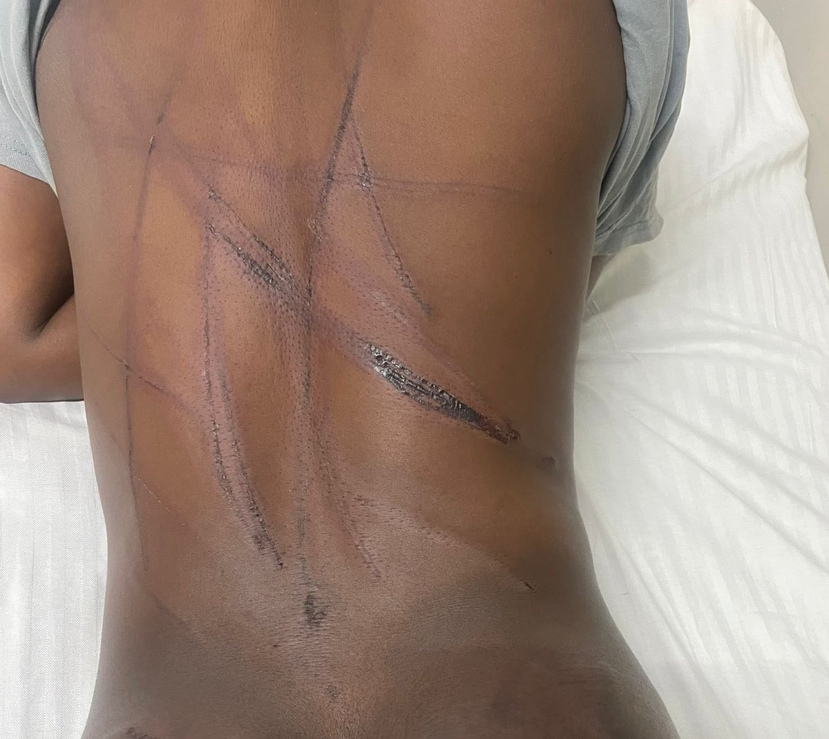 Recently elected CCC Cllr, <a href="/Cde_Wombe/">Councillor Womberaiishe Nhende</a> together with a fellow Champion Sanele were abducted by armed thugs in Belvedere next to Selbourne Rutledge School. The abductors used a Brown Toyota Fortuner &amp; a Silver Toyota Belta.
Here are some images showing their state after the ordeal.