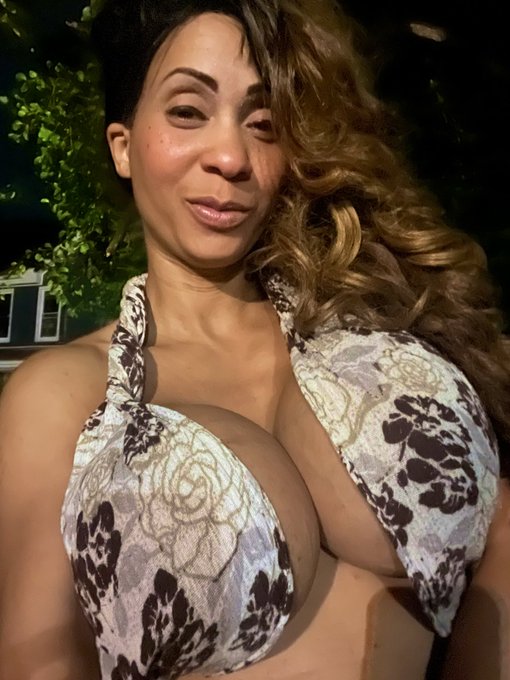 Mosquito bites. 🤷🏽&zwj;♀️ https://t.co/jMfYvA14Lj<a href="/tag/mvsales"class="tags"><span>#mvsales</span></a>