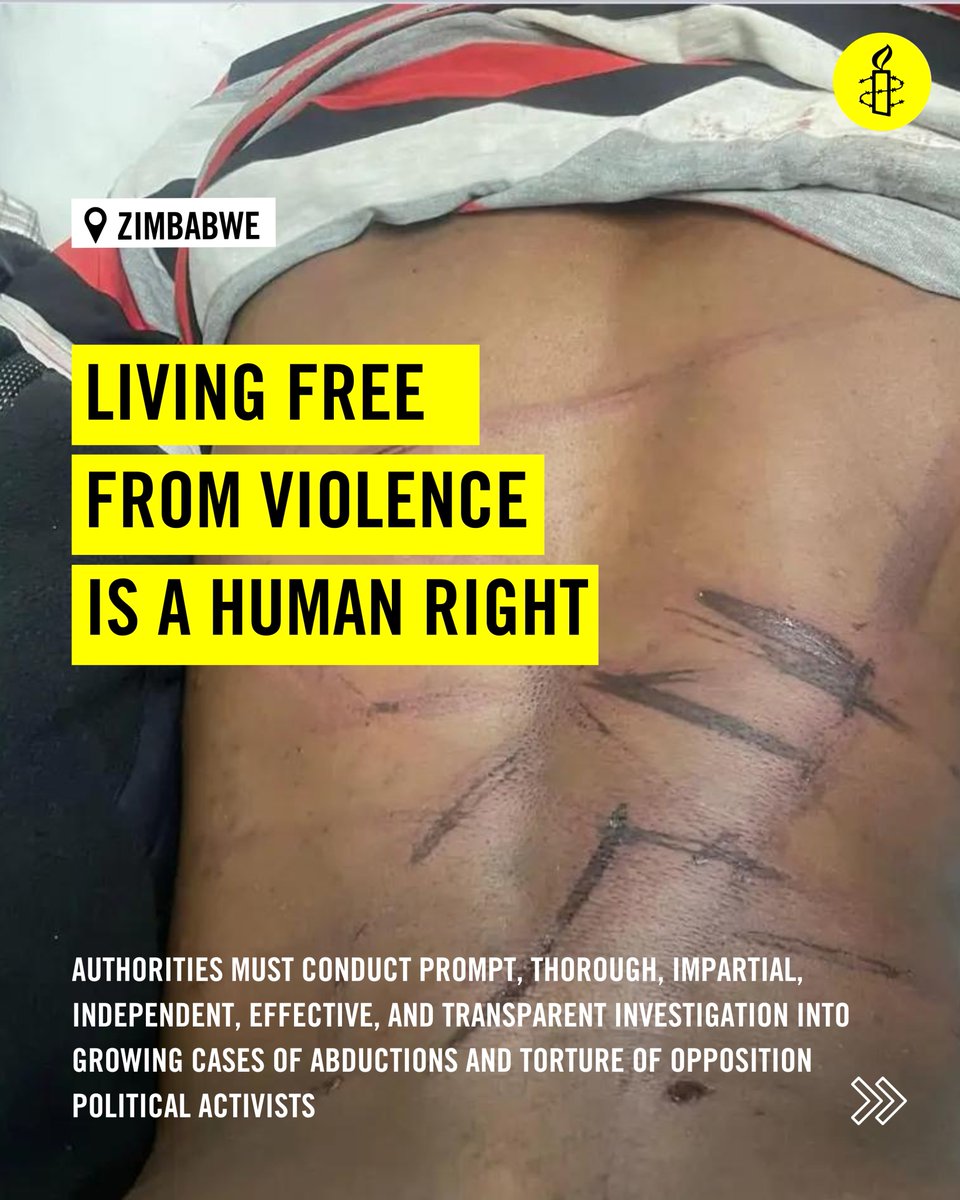 amnesty_zim's tweet photo. We strongly condemn the abduction and brutal assault of Womberaiishe Nhende, the elected Councillor for Glen Norah Ward 27 in Harare , and his colleague Sanele.
Reports indicate that @Cde_Wombe was abducted in Belvedere, tortured and dumped in Mapinga on the outskirts of Harare. https://t.co/o0oIY6Nge6
