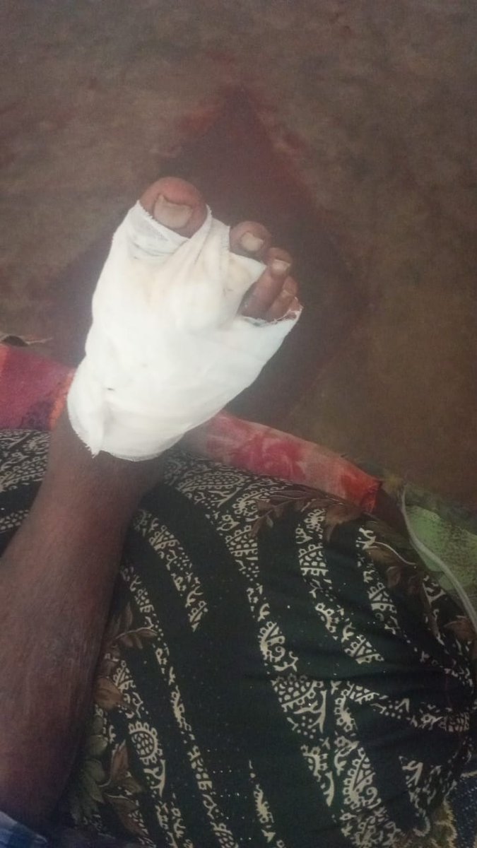 syedtsm16's tweet photo. @HariKrishnaCMO  Good evening, Sir

Very need full favour from your side, Sir

My friend father is suffering from sugar wond problem at foot..

Hope your response to little urgent. Sir https://t.co/Z3wY84nVZU