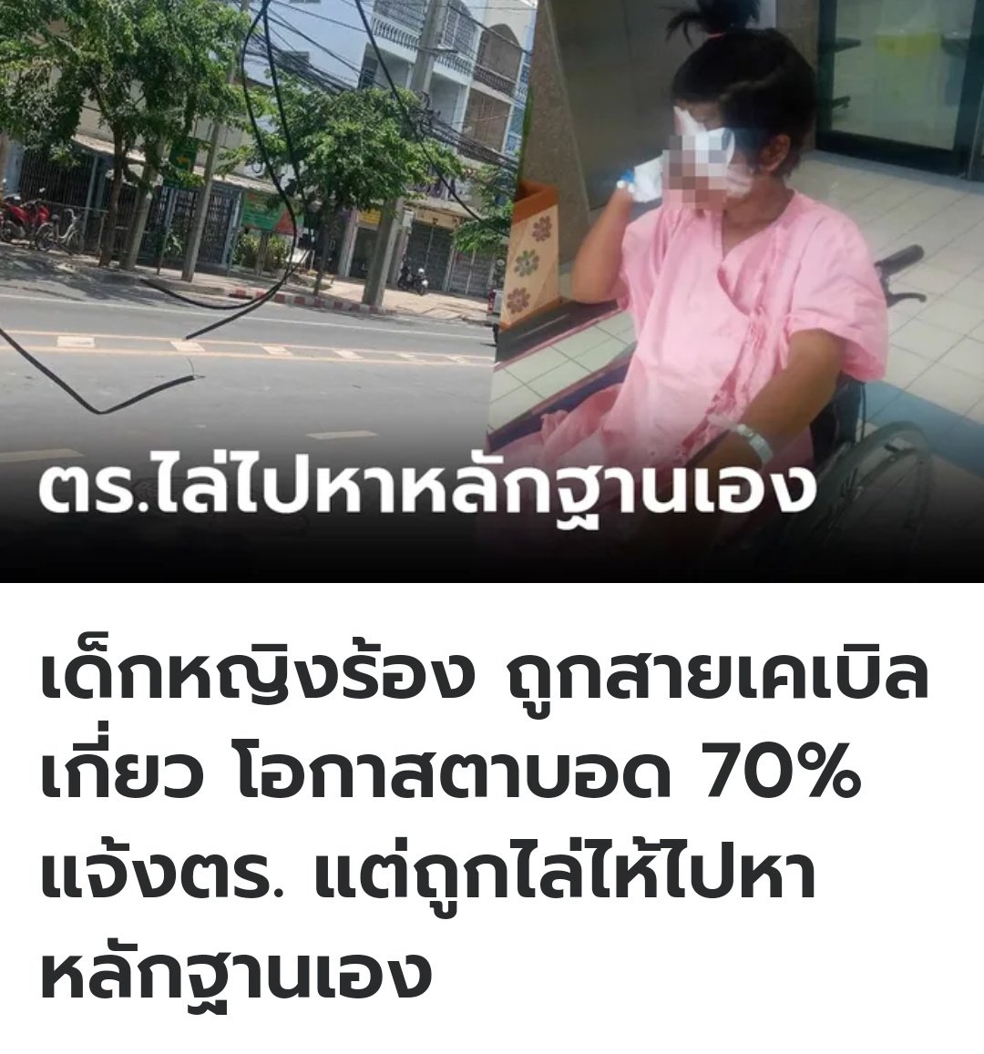 TW : สงสารน้องมาก น้องถูกสายเคเบิลเกี่ยวตากลางถนน   มีโอกาสตาบอดสูงถึง 70 % แต่ตำรวจแค่ลงบันทึกประจำวันไว้ ไม่รู้จะตามภาพวิดีโอยังไง ให้ไปตามหาเอง เขาเจ็บตัวขนาดนี้ มึงไม่คิดจะช่วยบ้างหรือไงกัน ส้นตีนมากจริงๆ!!!!!