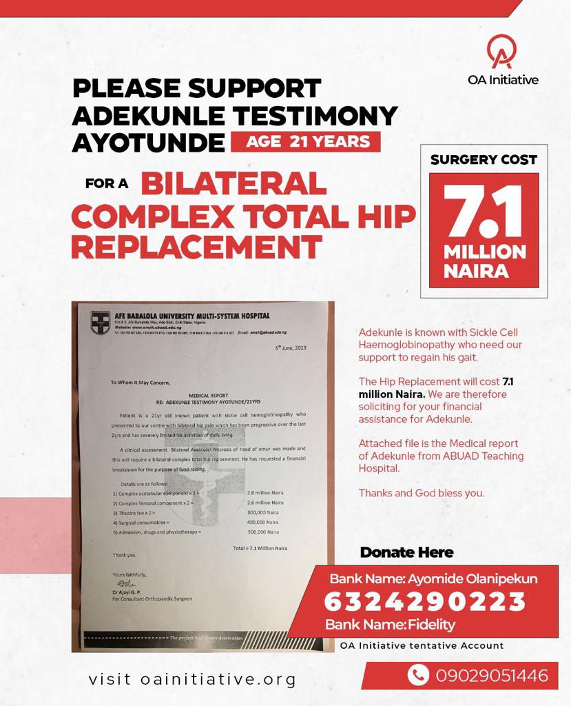 SUPPORT ADEKUNLE TESTIMONY AYOTUNDE (21 YEARS) FOR A BILATERAL COMPLEX TOTAL HIP REPLACEMENT

SURGERY COST: 7.1 MILLION NAIRA

Bank Name: Fidelity Bank
6324290223
Bank Name: Ayomide Olanipekun