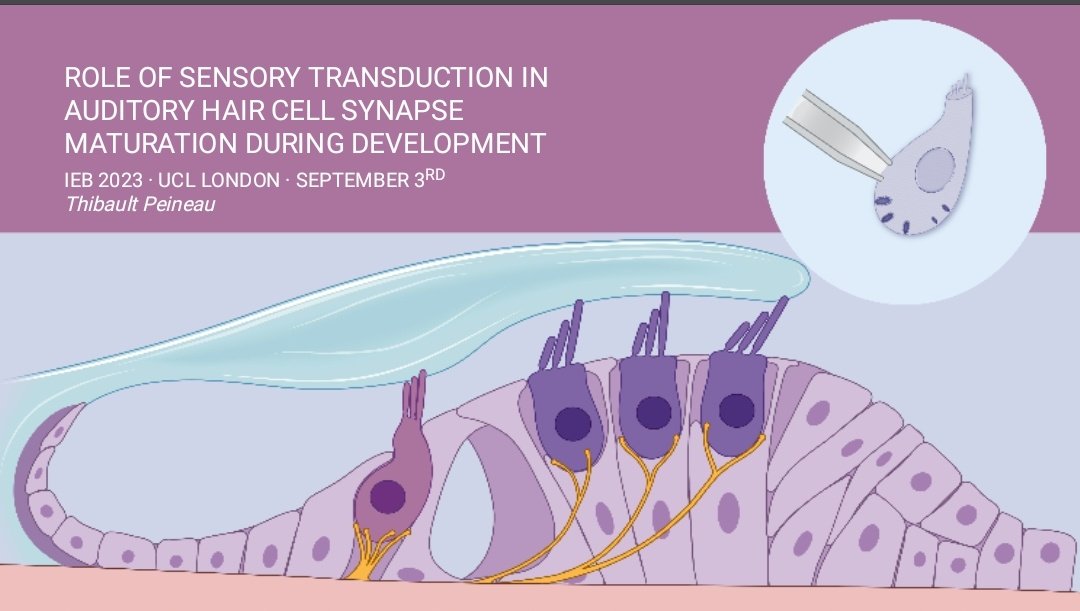 dr_ThibP's tweet photo. Presenting at the Inner Ear Biology 2023, at UCL 😳😳
#IEB2023 https://t.co/m4vLJ85TcZ