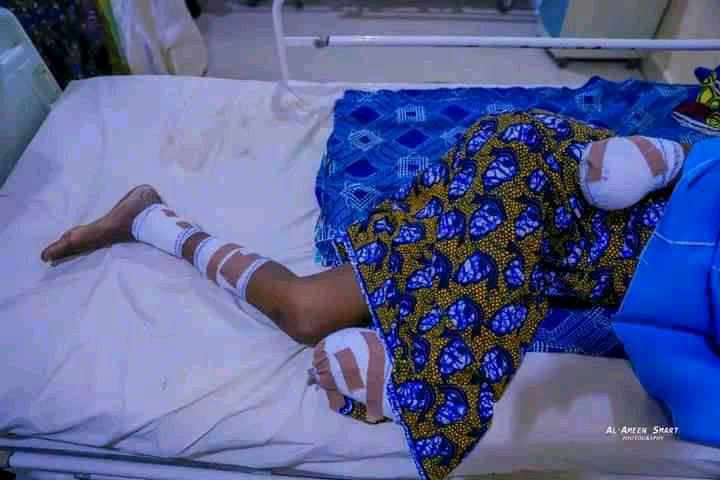 ShehuSfada's tweet photo. What a world!!!
In a fight with her husband, he decided to cut her hands &amp; legs and ran away💔

Allah ya isar mata, Allah yayi ma yadda kayi mata🙏🏻 https://t.co/CEnX6awV5u
