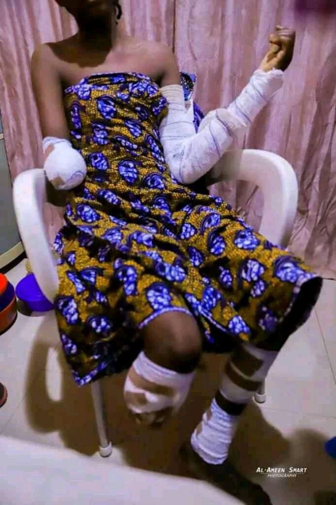 ShehuSfada's tweet photo. What a world!!!
In a fight with her husband, he decided to cut her hands &amp; legs and ran away💔

Allah ya isar mata, Allah yayi ma yadda kayi mata🙏🏻 https://t.co/CEnX6awV5u