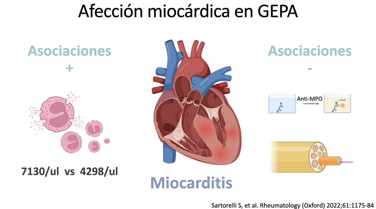 El compromiso cardíaco es un factor de mal pronóstico en Vasculitis ANCA, es MUCHO más común en la Granulomatosis Eosinofílica con Poliangitis (GEPA), que puede afectar el miocardio hasta en el 49% de los ptes. Abajo los datos de un importante estudio del GFEV #MedEd #MedTwitter