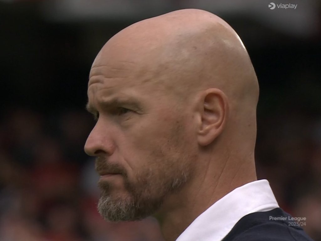 CFC_Janty's tweet photo. @Sanchooo10 Cook that bald fraud 😂😂😂😂😂 https://t.co/cakuhywWVP