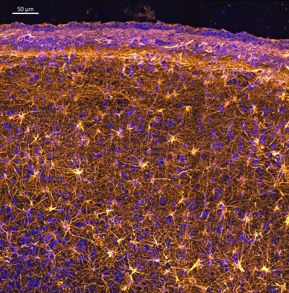 How do newborn neurons migrate in the developing cortex? They are guided by Radial Glia; these temporary cells (below) form a network, allowing neurons to be properly organized in the cortical plate. You don't want to mess up with this process! Markers: 🟡gfap 🔵dapi