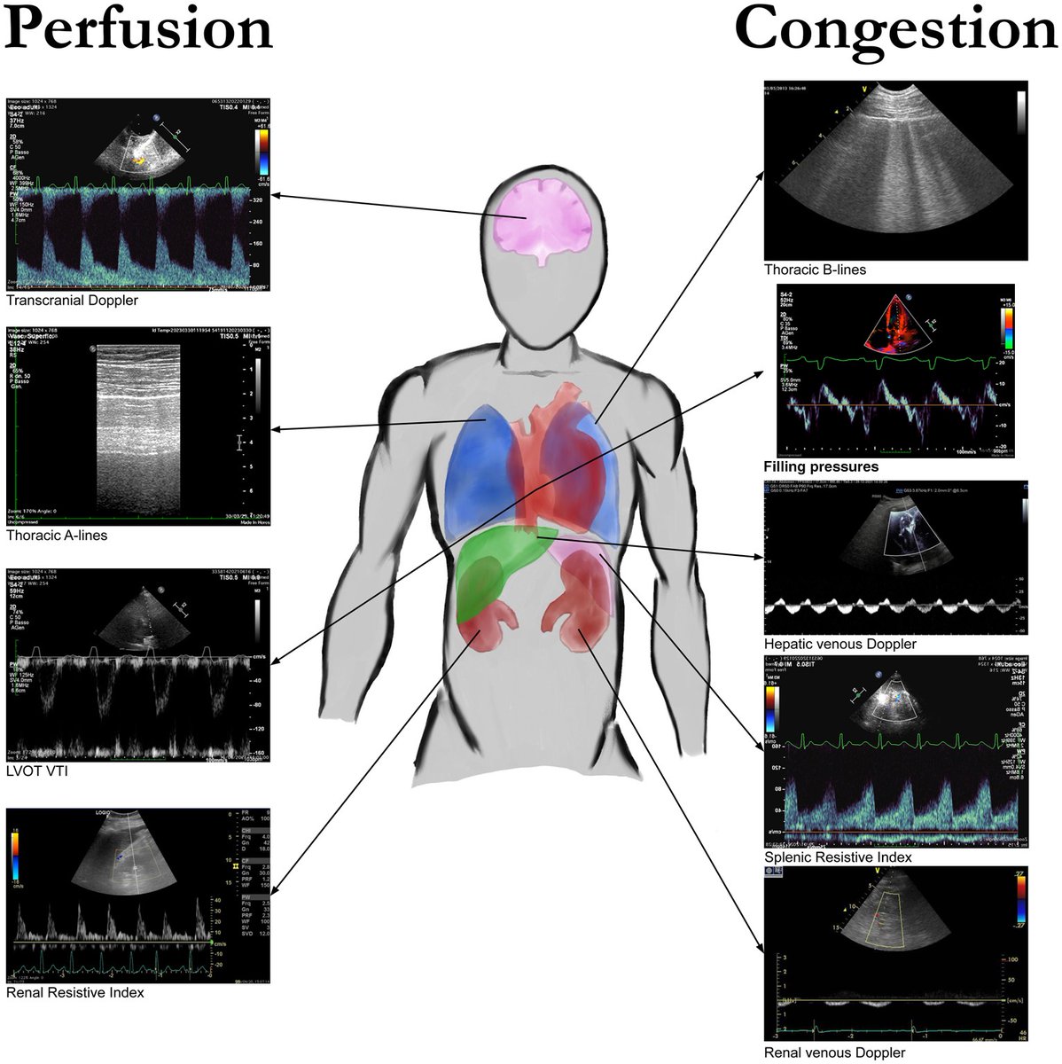 NephroPOCUS tweet media