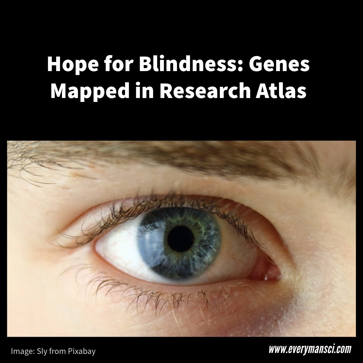 Harvard's Human Eye Cell Atlas: A Beacon of Hope for Blindness Treatment

#HarvardResearch #HumanEye #VisionAtlas #GeneTherapy #BlindnessTreatment #EyeHealth #MedicalBreakthrough #ScienceNews #VisionResearch #HealthDiscoveries #science #harvard