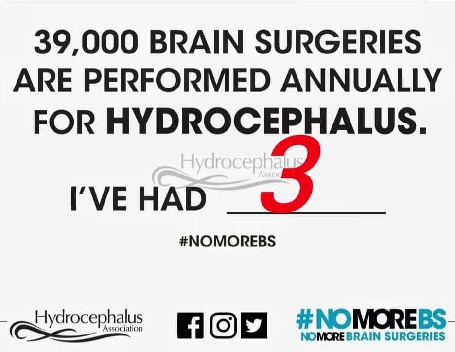 ScottLim5's tweet photo. #SpinaBifida #HydroBaby https://t.co/NBC9pJC4b2