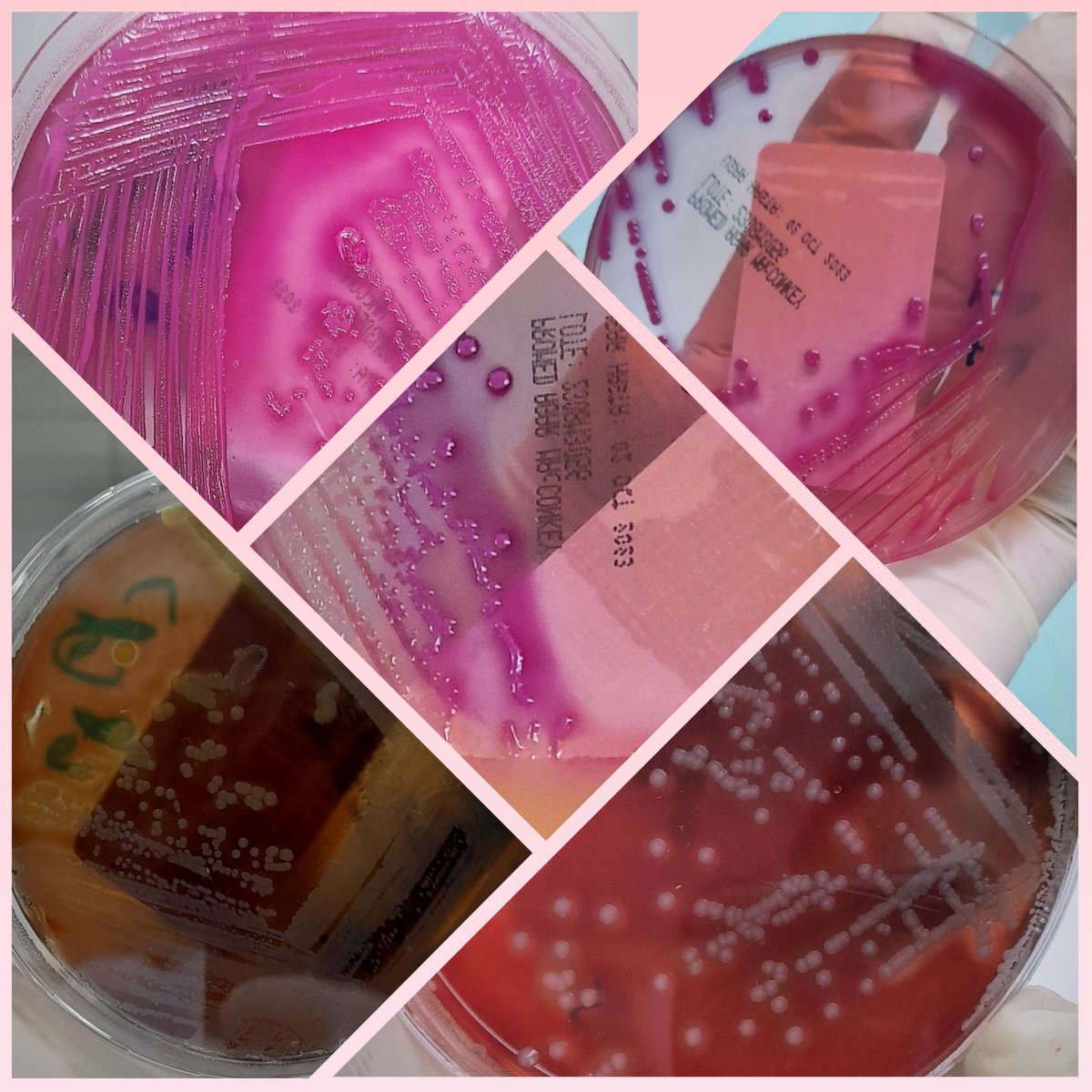 Notesoskr's tweet image. Microbiologia termino siendo una de mis rotaciones favoritas🤯. Algo que no pensaba al inicio xd.

#microbiology
#biomedicina
#sciencelaboratory
#science