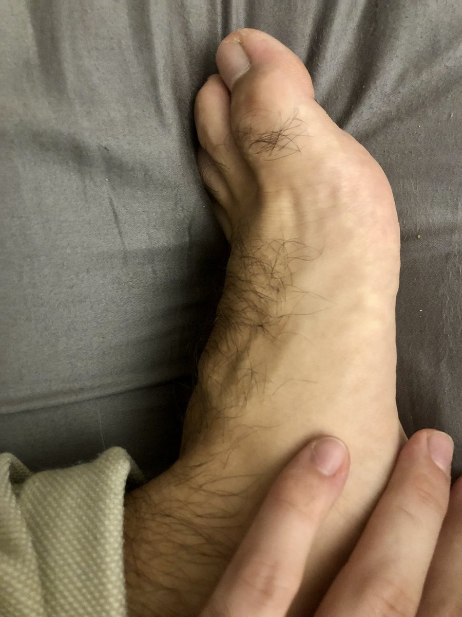 elpiedepato's tweet photo. Feet and toes #malefeet #hairyfeet https://t.co/k1S55ghBoO