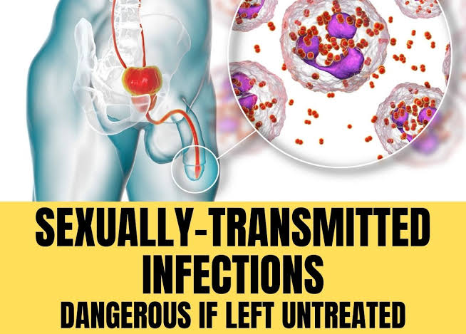 Today is #Worldsexualhealthday
Please if you're sexually active, read & share. 

Sexually transmitted infections can be worrisome.

Here are 5 STI you should know about, what to do. See if you have any symptoms and try and go to a hospital

Please share