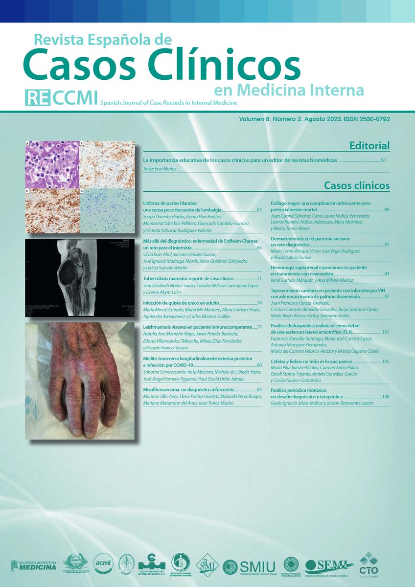 📢Se ha publicado recientemente el volumen 8⃣ - número 2⃣ de agosto de 2023 de <a href="/RECCMI_SEMI/">RECCMI</a> ¡No te lo pierdas!  
🔹Acceso directo al número y al contenido, aquí: 
reccmi.com/RECCMI/issue/v…
#SEMITuit 
#MedicinaInterna