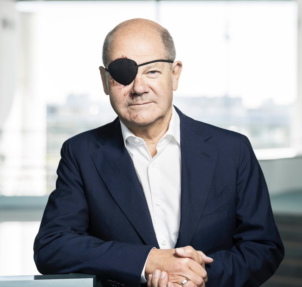 DeinUpdate's tweet photo. Olaf Scholz hatte einen Sportunfall und hat nun ein Bild von sich gepostet. 

Dazu sagt er:

"Bin gespannt auf die Memes. Danke für die guten Wünsche, sieht schlimmer aus, als es ist"