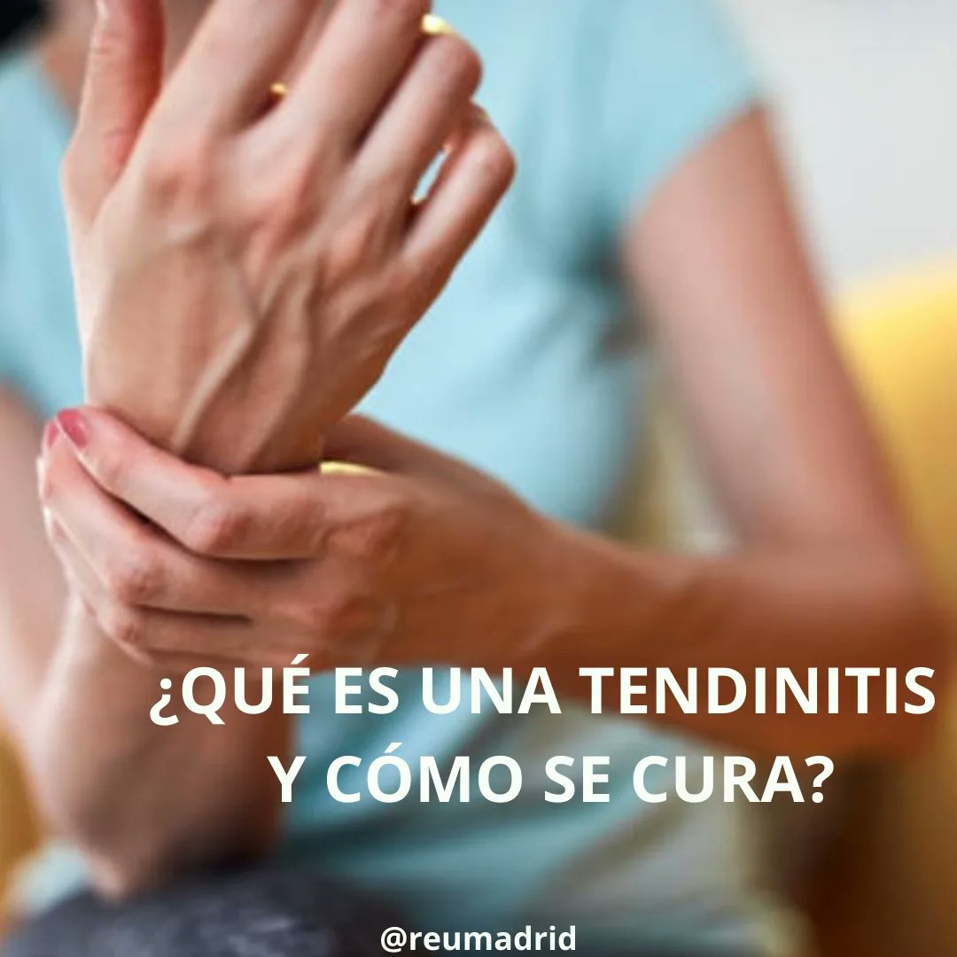 reumadrid's tweet photo. La tendinitis o tendinopatía es una inflamación o irritación de los tendones, que son unas estructuras fibrosas que conectan los músculos con los huesos. 
Lo más habitual es que afecte a los tendones que dan soporte a las articulaciones que más uso le damos habitualmente. https://t.co/hK8QdEsBOo