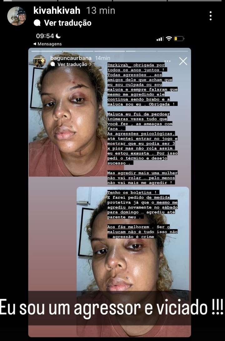 Choquei_Trap's tweet photo. 🚨 URGENTE: Recentemente no Instagram do rapper Bril, sua ex cônjuge expõe que o rapper agrediu inúmeras vezes e mostra machucados que sofreu no último sábado para domingo.
A moça diz que já fez o boletim e pediu uma medida protetiva.
Os posts foram feito no Instagram do rapper. https://t.co/ExEx86DBGP