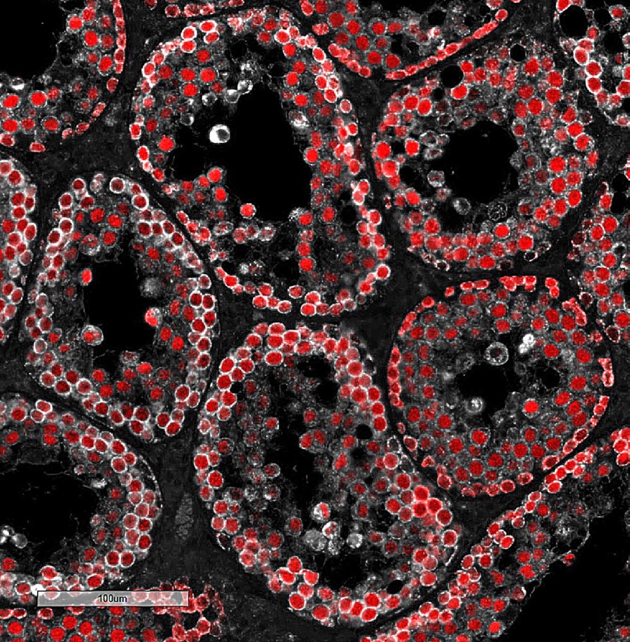 Up to 7% of men experience infertility. The cause is often unknown but, in some cases, associated with defects in cell units called mitochondria. This study found a novel mechanism of infertility in mice lacking PARL, a mitochondrial enzyme. pubmed.ncbi.nlm.nih.gov/37505079/