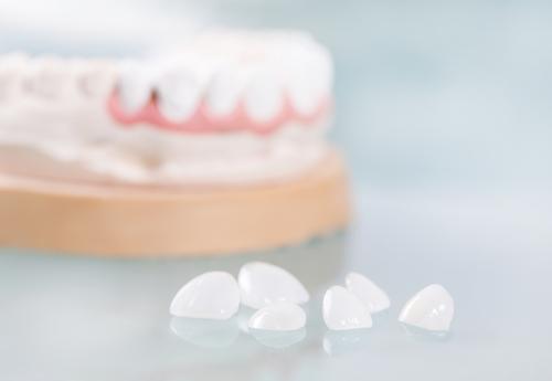 RiiliStudio's tweet photo. Quando si può ricorrere alle faccette dentali?
Molte persone sono convinte che abbiano solo una funzione “estetica”, ma in realtà le faccette si rivelano utili in diversi trattamenti odontoiatrici.
#FaccetteDentali #Informazione
#StudioDentistico
#Siracusa
#ANDI https://t.co/3149Y6lssy
