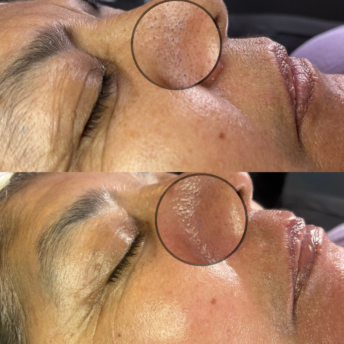 ariesomnia's tweet photo. This is your sign to book a facial with me 🤩 

https://t.co/furHFImg87 https://t.co/kCl4XBkeHR