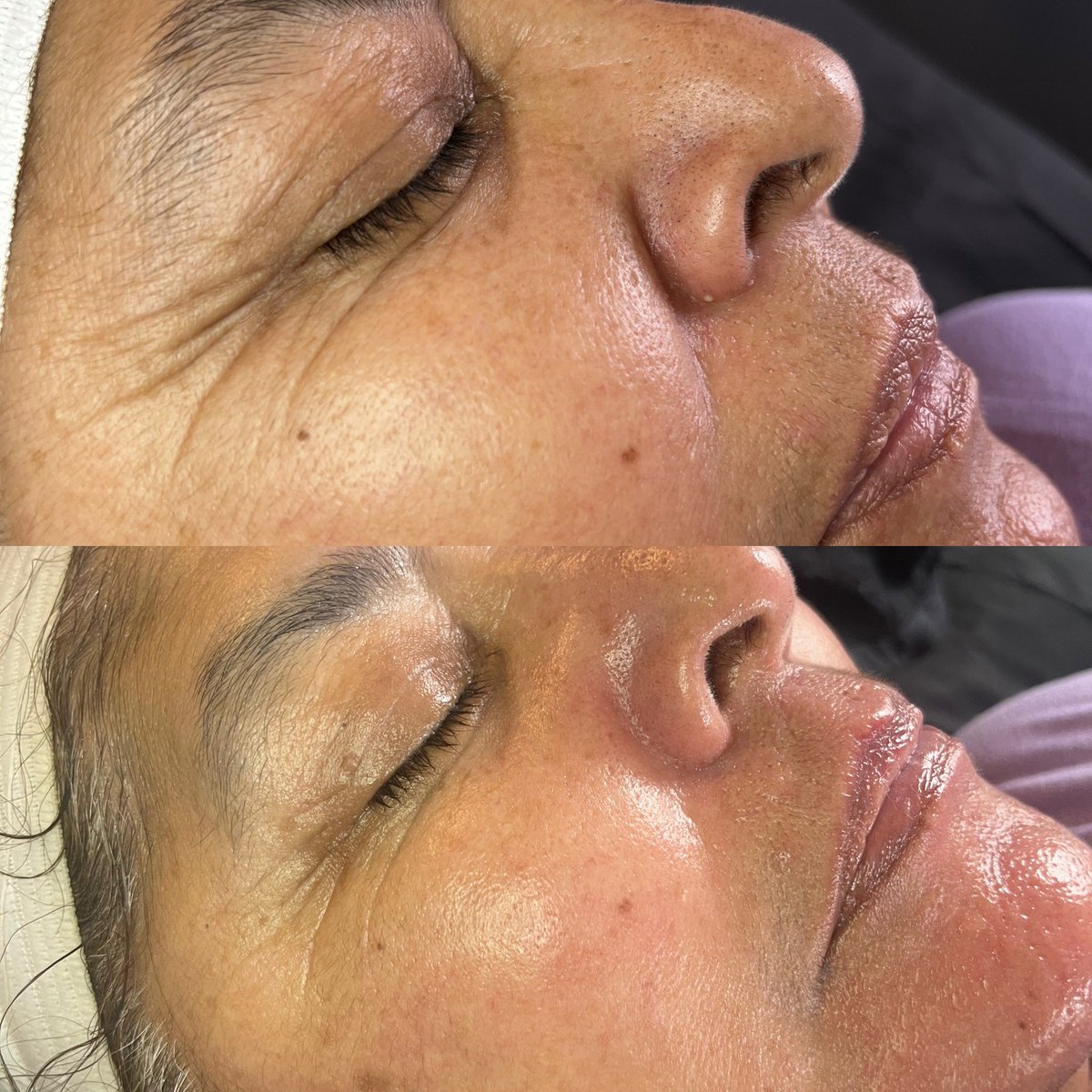 ariesomnia's tweet photo. This is your sign to book a facial with me 🤩 

https://t.co/furHFImg87 https://t.co/kCl4XBkeHR