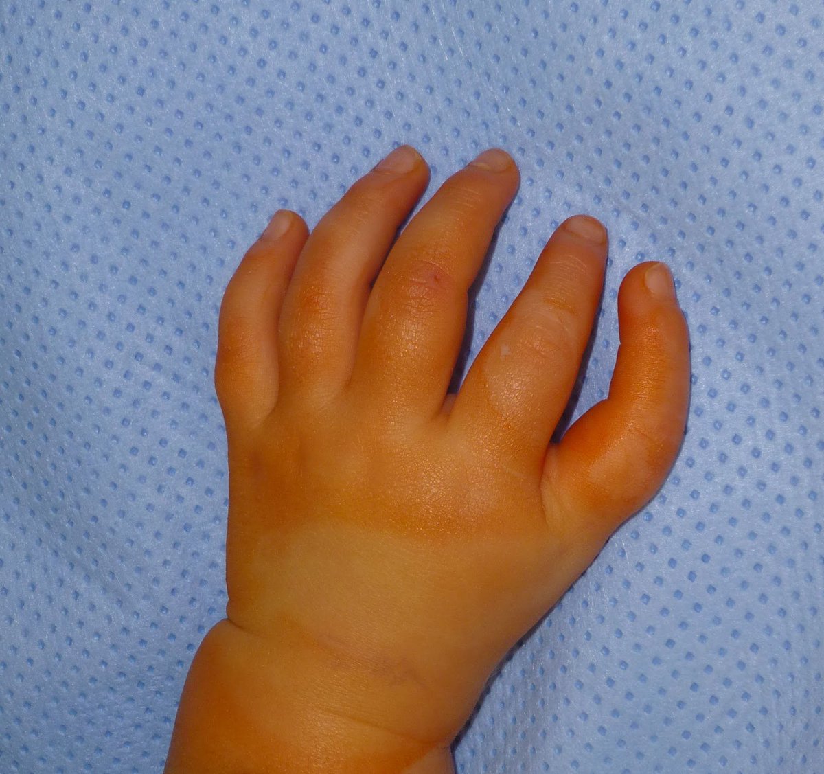 slashwarrior22's tweet photo. @Wisteria_RBLX @PHLOWERRR are these your hands lmaoo https://t.co/f7Bu4ajffC