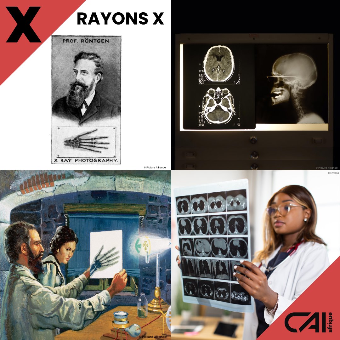 halloafrique's tweet photo. #AllemagnedeA_Z: X=rayons X, une découverte🇩🇪 révolutionnaire
Le physicien🇩🇪#Röntgen est l'auteur de cette découverte qui lui a valu le #PrixNobel de physique en 1901. Il les a nommé #RayonX à cause de leur nature inconnue à l'époque
Ils sont aussi appelés #Röntgenstrahlen en🇩🇪 https://t.co/D5AkEnSk4A