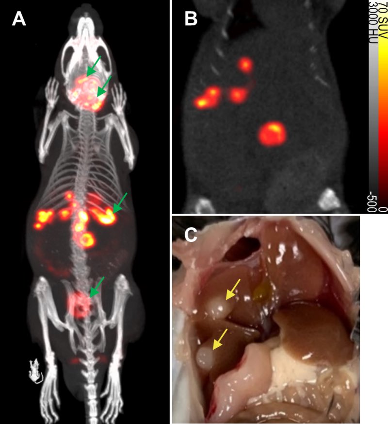 Aiims1742's tweet photo. #OpenAccess in @cell_stress from @CSHL 
Sensitive, non-immunogenic in vivo imaging of cancer metastases and immunotherapy response
https://t.co/oH4whGSWw0
This is a useful tool for in vivo imaging of metastatic disease in immune competent models of #PancreaticCancer (& other solid tumors) without the immunogenicity associated with luciferase reporters. The authors utilized the murine sodium iodide symporter (mNIS) paired with whole body SPECT/CT imaging for sensitive detection of metastatic disease. @JanowitzTobias