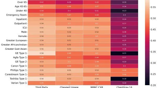 Radiology: Artificial Intelligence (@radiology_ai) on Twitter photo Four state-of-the-art deep learning CXR classifiers showed varied performance in different patient, setting, and pathology subgroups doi.org/10.1148/ryai.2… <a href="/monish_ahl/">Monish Ahluwalia</a> <a href="/mohannadhussain/">Mohannad Hussain</a> <a href="/THP_hospital/">Trillium Health Partners</a> #ChestRad #DeepLearning #MachineLearning Four state-of-the-art deep learning CXR classifiers showed varied performance in different patient, setting, and pathology subgroups doi.org/10.1148/ryai.2… <a href="/monish_ahl/">Monish Ahluwalia</a> <a href="/mohannadhussain/">Mohannad Hussain</a> <a href="/THP_hospital/">Trillium Health Partners</a> #ChestRad #DeepLearning #MachineLearning