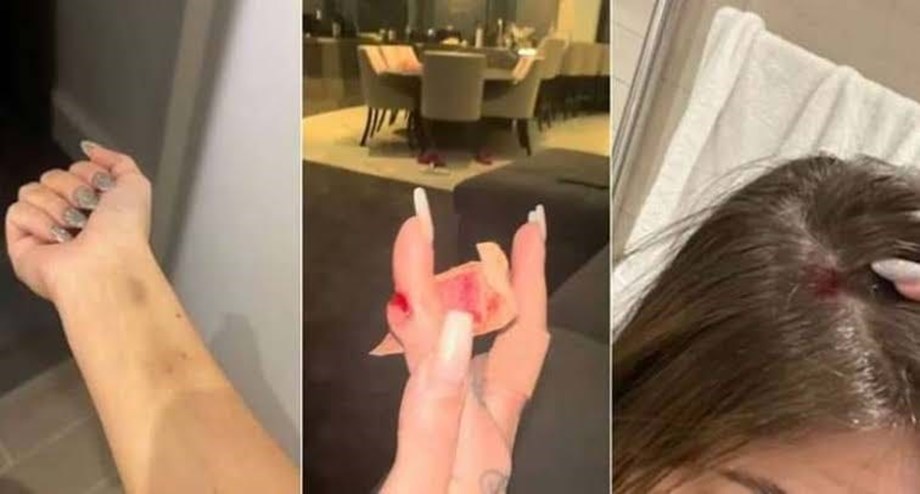 ItsAWagWagWorld's tweet photo. #Antony's ex-girlfriend #GabrielaCavallin shared new WhatsApp messages and injury pics amid allegations of domestic violence. #ManchesterUnited https://t.co/kslR0ZVF2H